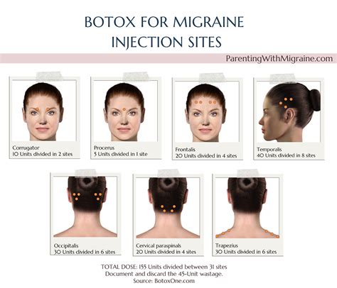 Botox 100 unit injection. . Botox injections for migraines procedure code